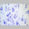 Neuronas Nissl 13.jpg
